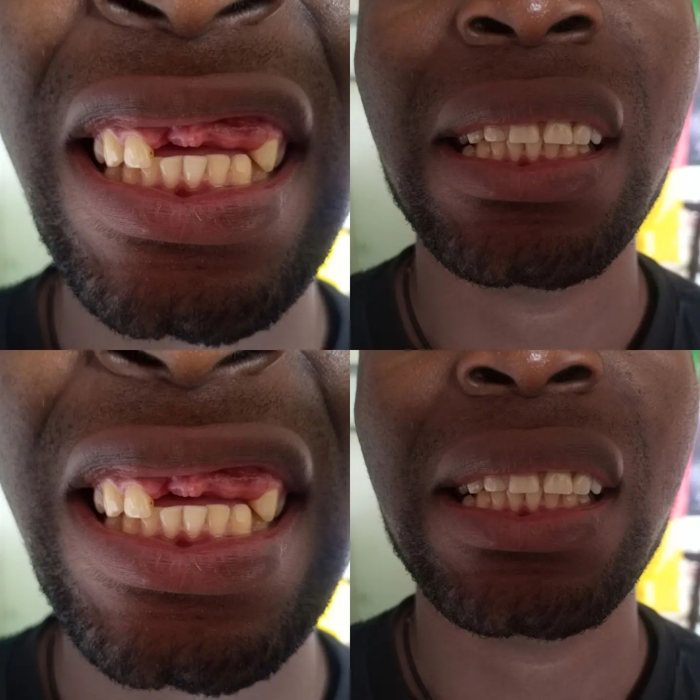 Comprehensive dental treatment before and after